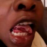 Douala, elle coupe l’extrémité du pénis de son mari, pendant son sommeil après une nuit d’infidélité